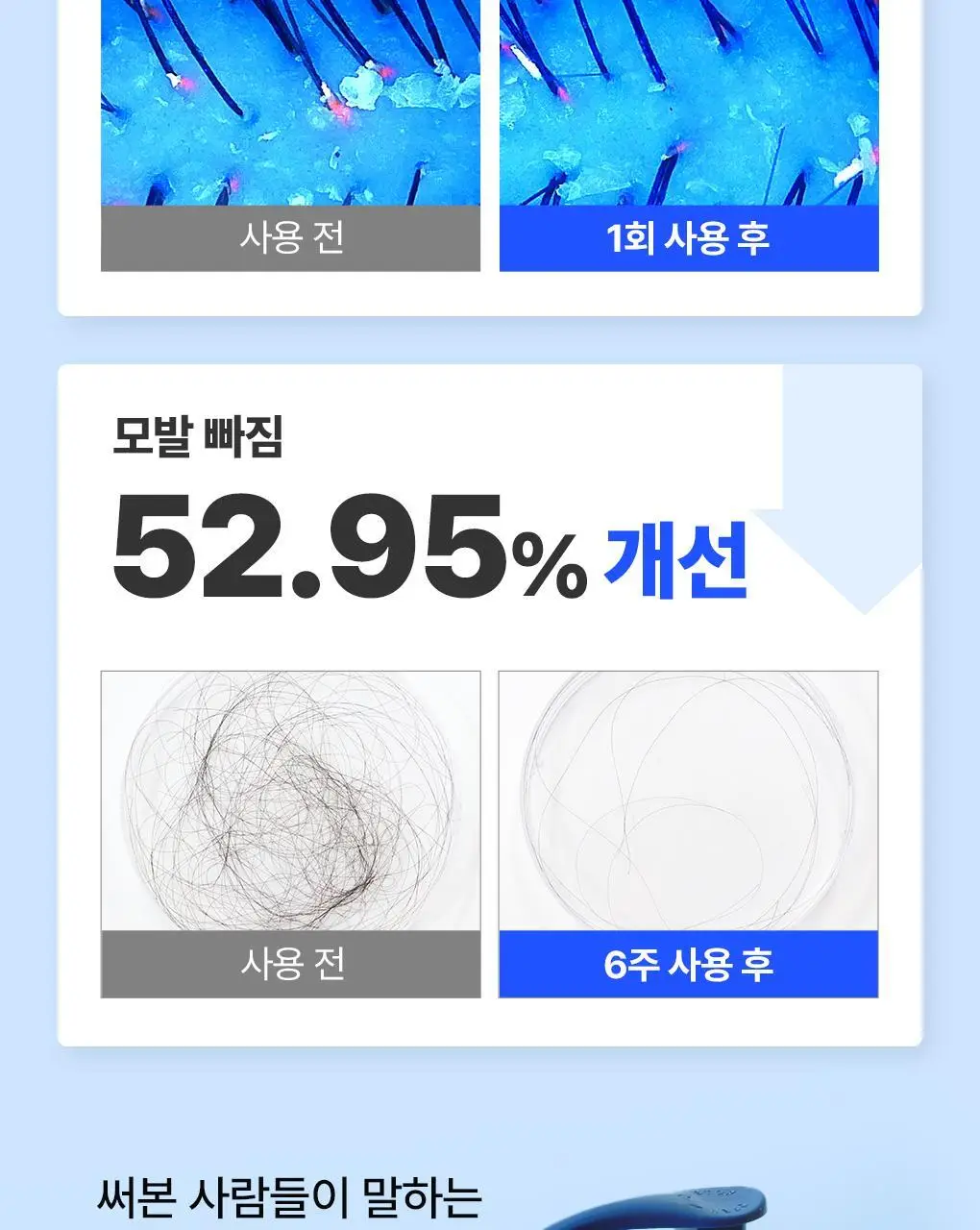 [두피 세정] 닥터방기원 랩 샴푸 EX 탈모 케어 샴푸 (두피 노폐물 제거) 상세페이지 5